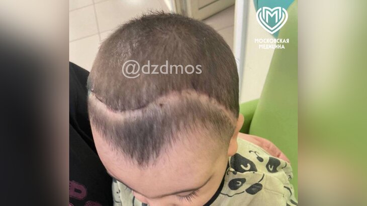 ���������� ����� ������� �������������� 1,5-������� ������� � ����������� ������