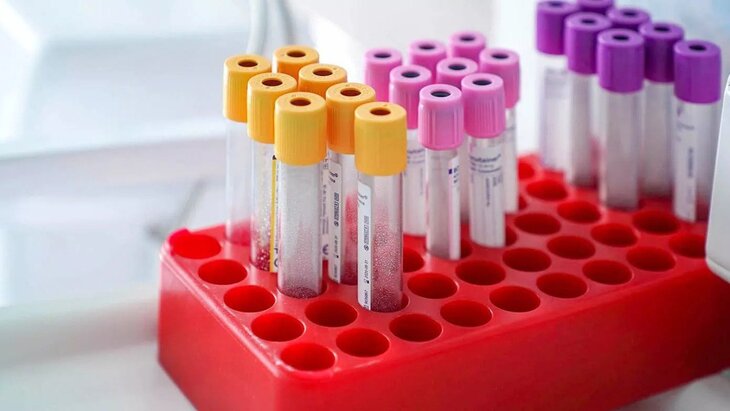 ��������� ���������� ������� �������� �� ���������� ����������� ��������