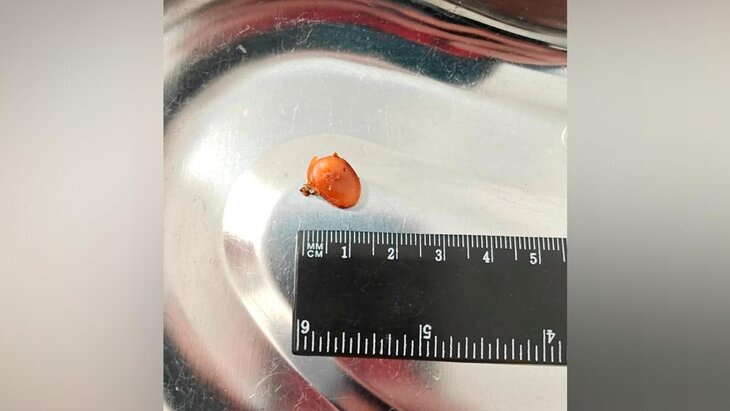 ������� ��� ���� �������� � ������� � ��� ������� ��-�� ������ ������