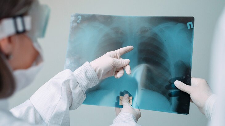 ������ ����������� ������������� � ����� ���� � ���������