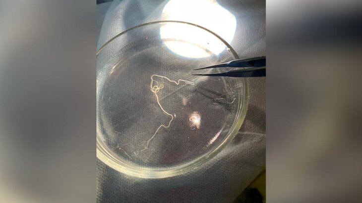 ����� � ��� ���������� �����-�������� �� ������ ���� ����� ���������