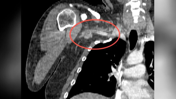 � ����������� ����� �������� �� ���� ������� 25-������������� �����