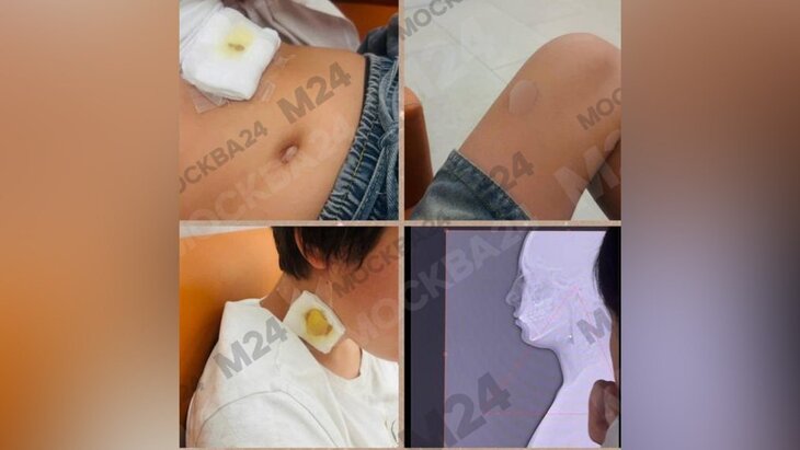 �� �������� ���� ����� ��������� ����������� ������� �� ���������� � �����