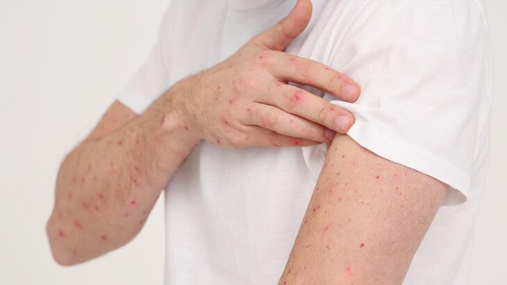 �������������� ��������� ����� �������� � ������ ������� �� 28% � 2024 ����