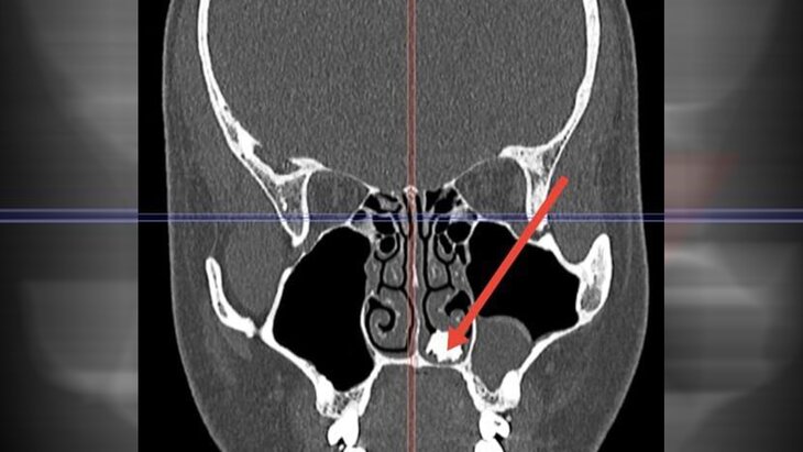 ������������ ����� �������� �������� ��� �� ���� 22-������� ��������