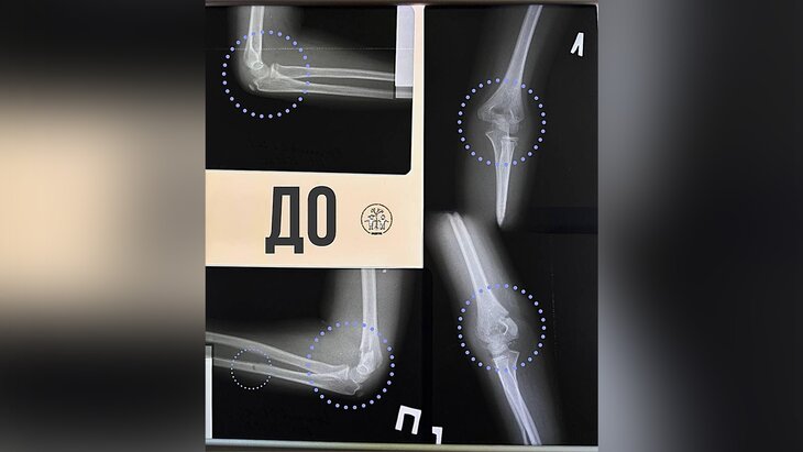 ������������ ����� �������������� ��������, ���������� ���� ��� �������